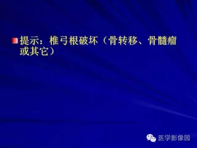 【PPT】脊柱各种征象的介绍