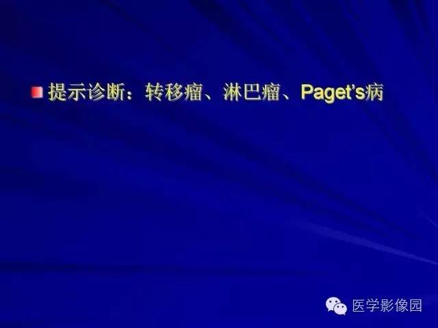 【PPT】脊柱各种征象的介绍