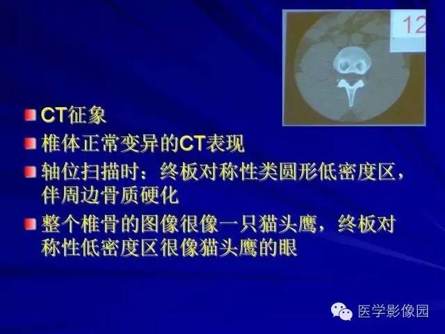 【PPT】脊柱各种征象的介绍