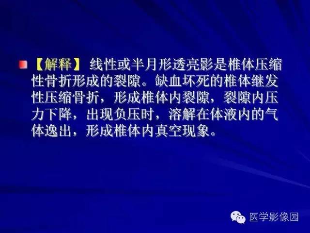 【PPT】脊柱各种征象的介绍