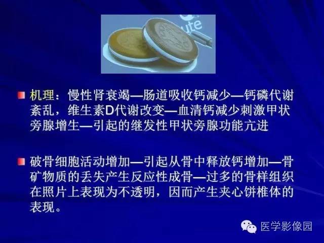 【PPT】脊柱各种征象的介绍