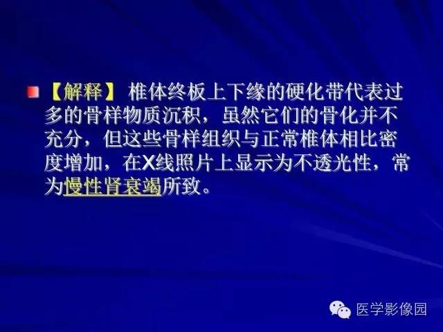 【PPT】脊柱各种征象的介绍