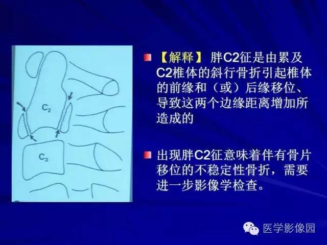 【PPT】脊柱各种征象的介绍