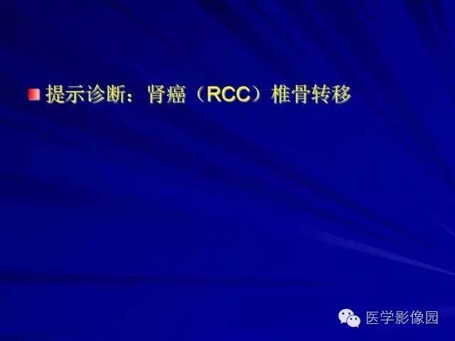 【PPT】脊柱各种征象的介绍