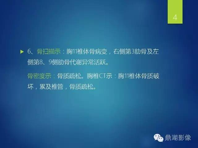 【病例】胸椎浆细胞瘤1例影像表现