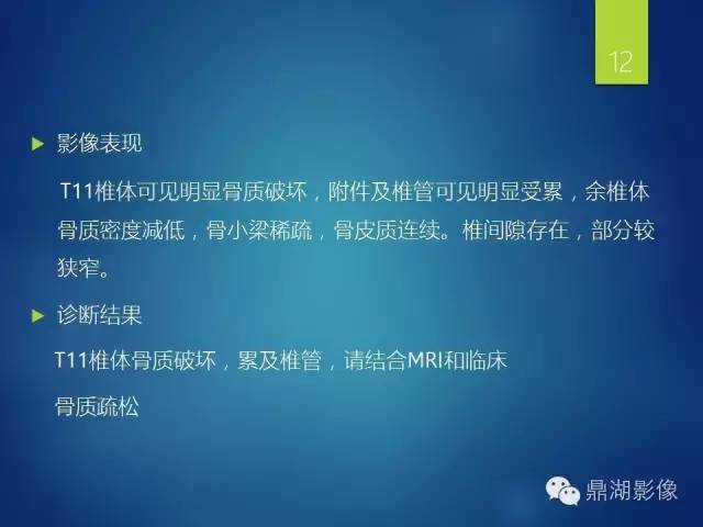 【病例】胸椎浆细胞瘤1例影像表现