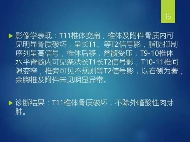 【病例】胸椎浆细胞瘤1例影像表现