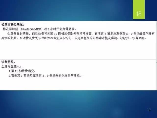 【病例】胸椎浆细胞瘤1例影像表现