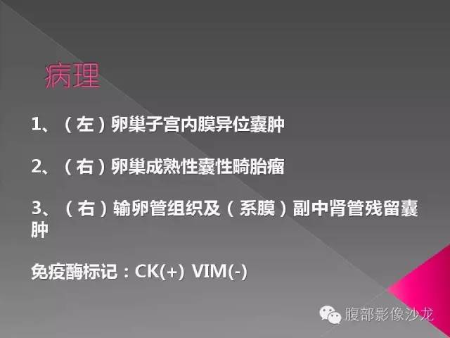 【病例】右侧卵巢囊性畸胎瘤1例CT及MR影像表现 【病例】右侧卵巢囊性畸胎瘤1例CT及MR影像表现