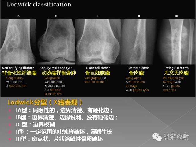 【PPT】良/恶性骨肿瘤影像表现及诊断