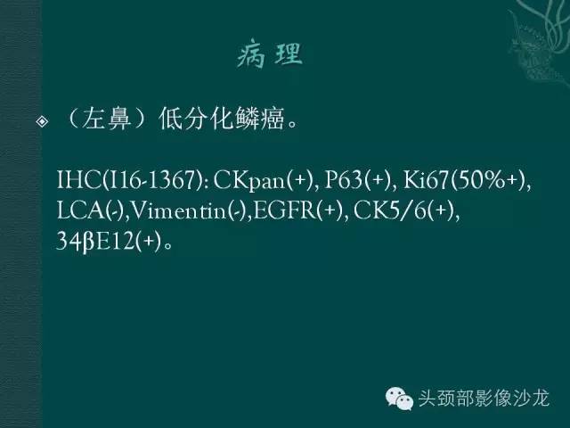 【病例】左鼻低分化鳞癌1例CT及MR影像表现 【病例】左鼻低分化鳞癌1例CT及MR影像表现