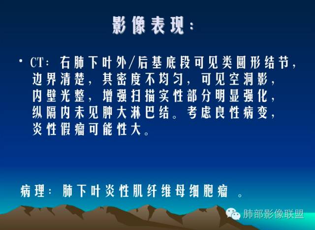 【病例】一个诡异的空洞——炎性肌纤维母细胞瘤1例影像诊断分析