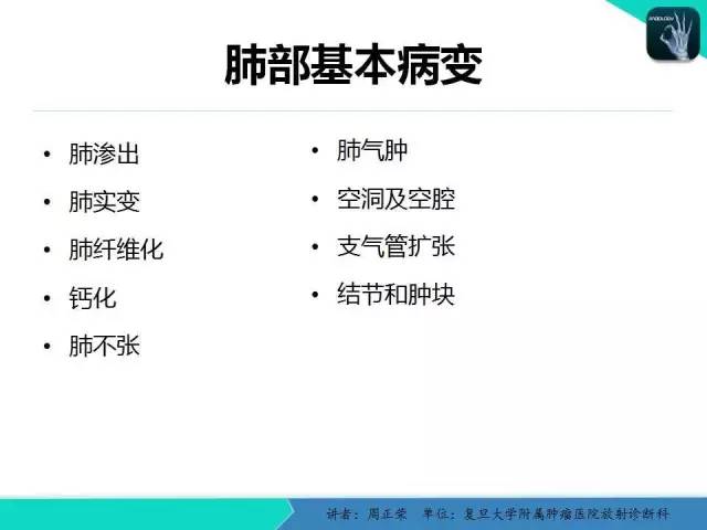 【PPT】肺癌的CT诊断