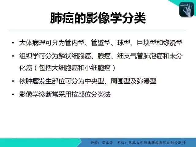 【PPT】肺癌的CT诊断
