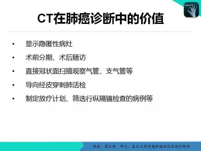 【PPT】肺癌的CT诊断