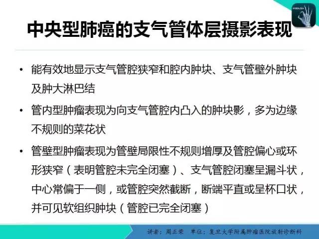 【PPT】肺癌的CT诊断