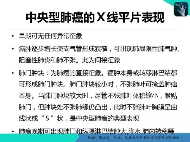 【PPT】肺癌的CT诊断