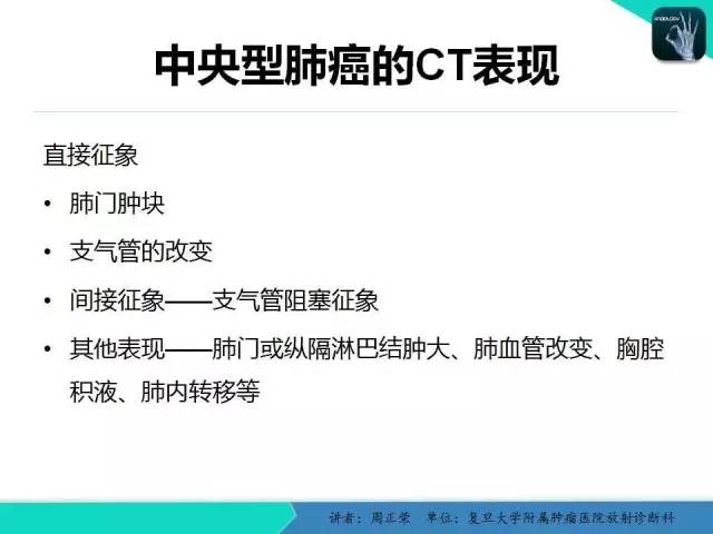 【PPT】肺癌的CT诊断