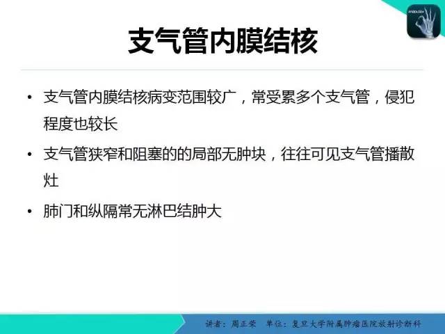 【PPT】肺癌的CT诊断