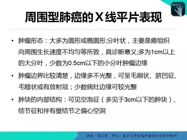 【PPT】肺癌的CT诊断