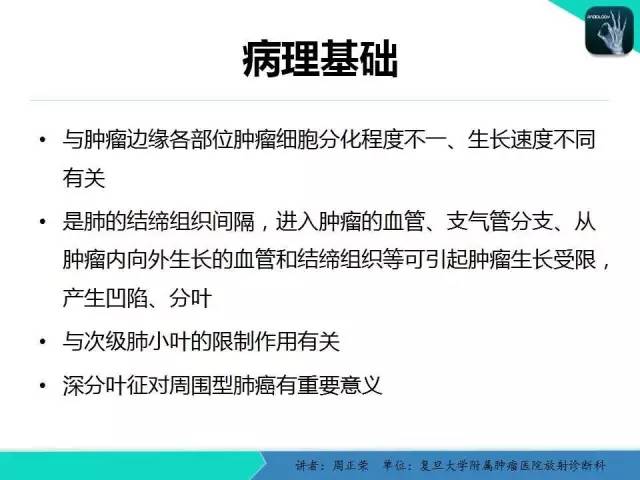 【PPT】肺癌的CT诊断