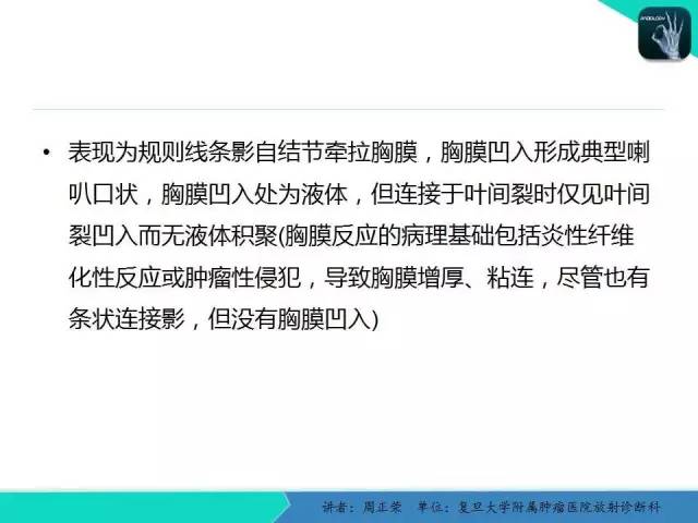 【PPT】肺癌的CT诊断