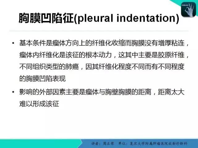 【PPT】肺癌的CT诊断