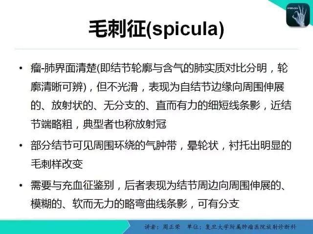 【PPT】肺癌的CT诊断