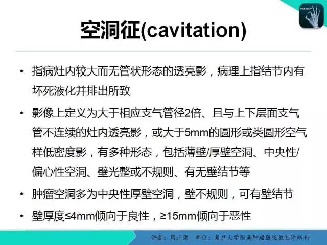 【PPT】肺癌的CT诊断