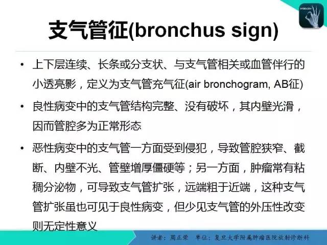 【PPT】肺癌的CT诊断