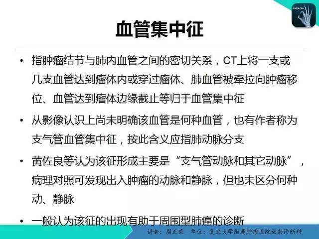 【PPT】肺癌的CT诊断