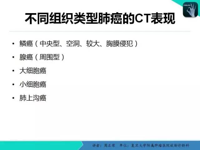 【PPT】肺癌的CT诊断