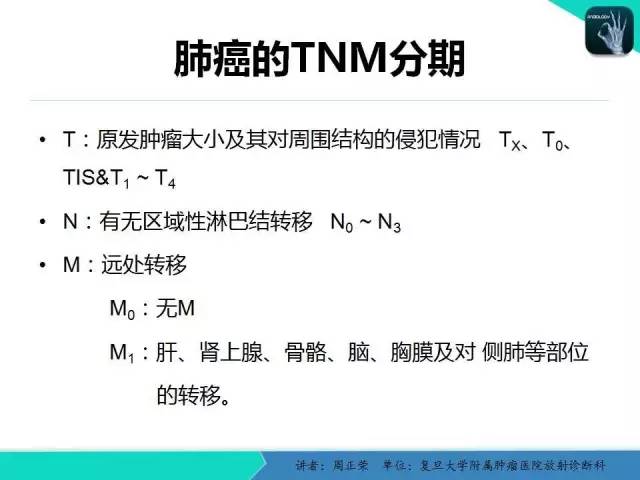 【PPT】肺癌的CT诊断
