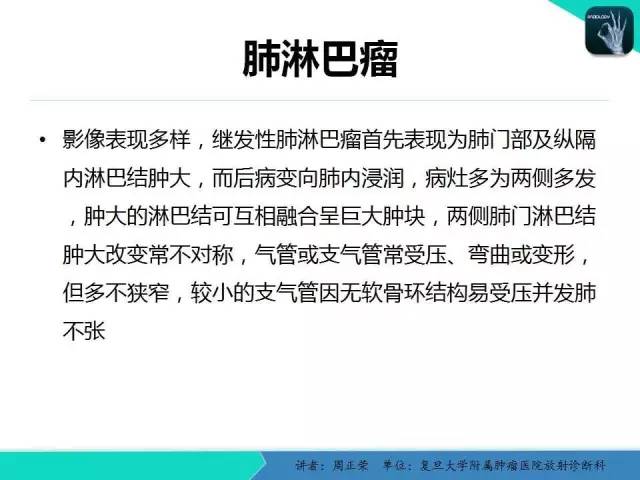 【PPT】肺癌的CT诊断
