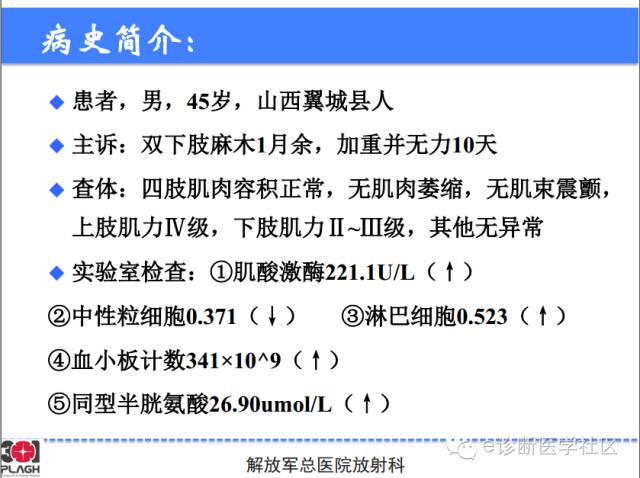 【病例】胸椎浆细胞瘤1例CT及MR影像表现