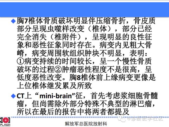 【病例】胸椎浆细胞瘤1例CT及MR影像表现