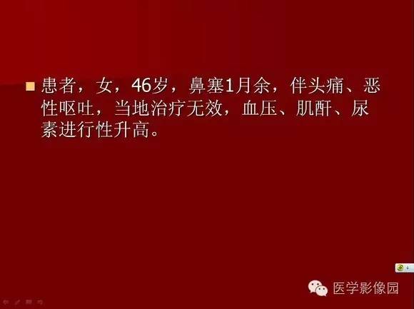 【病例】肺部韦格纳肉芽肿1例CT影像表现