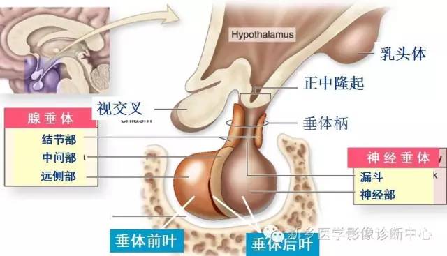 垂体柄阻断综合征 垂体柄阻断综合征