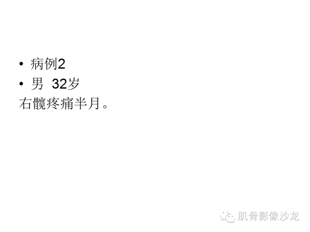 【病例】右股骨粗隆骨母细胞瘤1例