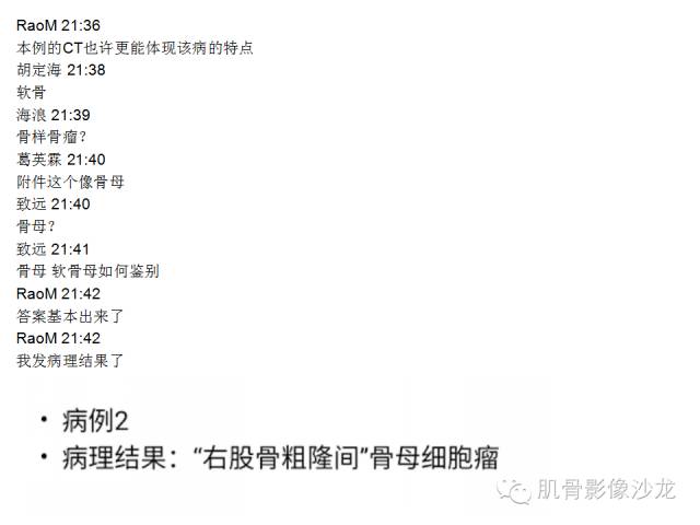 【病例】右股骨粗隆骨母细胞瘤1例