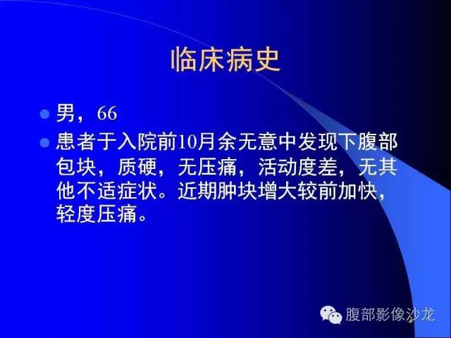 【病例】腹腔促结缔组织增生性纤维母细胞瘤1例CT影像表现