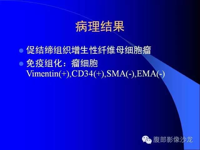 【病例】腹腔促结缔组织增生性纤维母细胞瘤1例CT影像表现 【病例】腹腔促结缔组织增生性纤维母细胞瘤1例CT影像表现