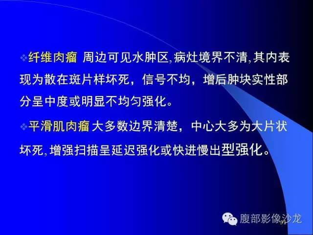 【病例】腹腔促结缔组织增生性纤维母细胞瘤1例CT影像表现 【病例】腹腔促结缔组织增生性纤维母细胞瘤1例CT影像表现