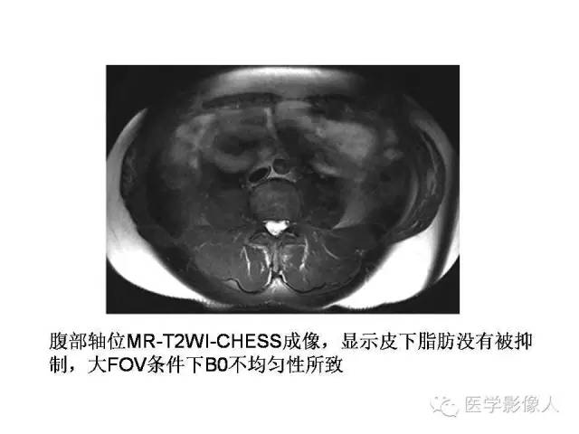 【PPT】肌骨系统MR成像脂肪抑制技术