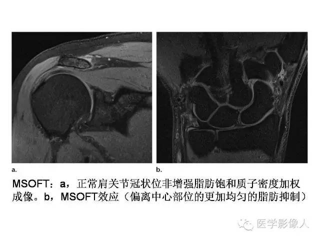 【PPT】肌骨系统MR成像脂肪抑制技术
