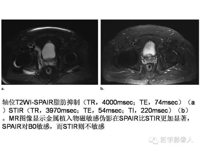 【PPT】肌骨系统MR成像脂肪抑制技术