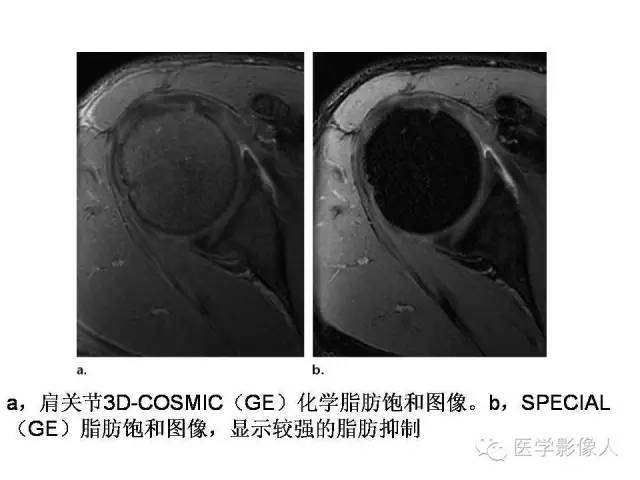 【PPT】肌骨系统MR成像脂肪抑制技术