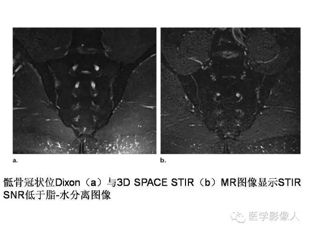 【PPT】肌骨系统MR成像脂肪抑制技术
