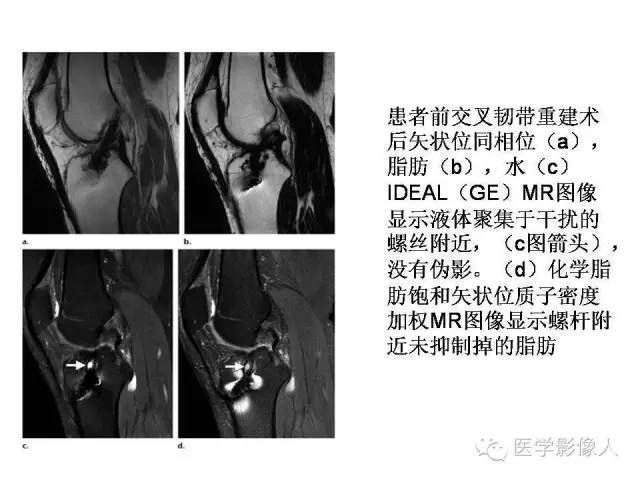 【PPT】肌骨系统MR成像脂肪抑制技术