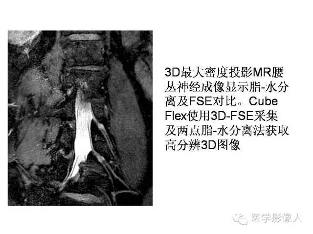 【PPT】肌骨系统MR成像脂肪抑制技术